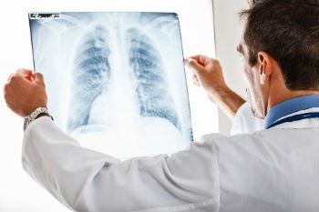 Doctor misread X-rays
