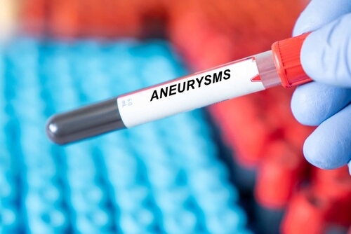 Aneurysm Misdiagnosis