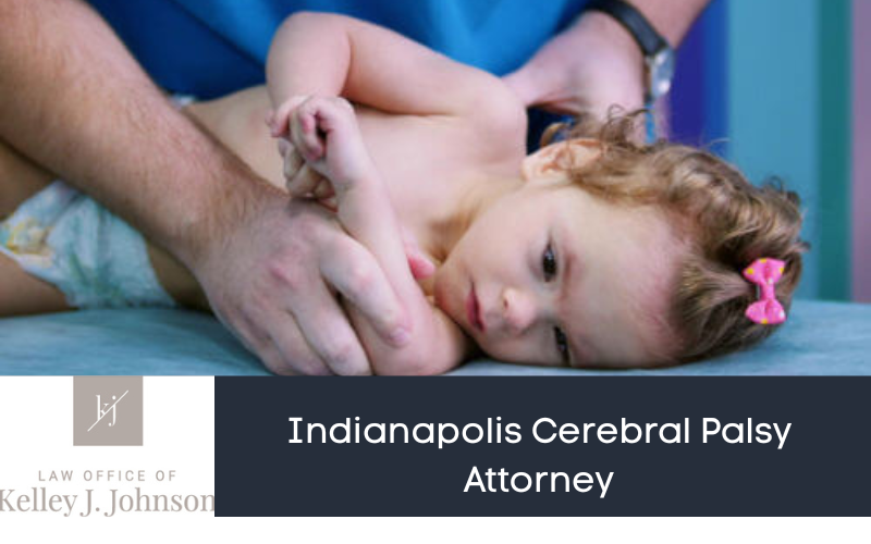 Indianapolis Cerebral Palsy Lawyer