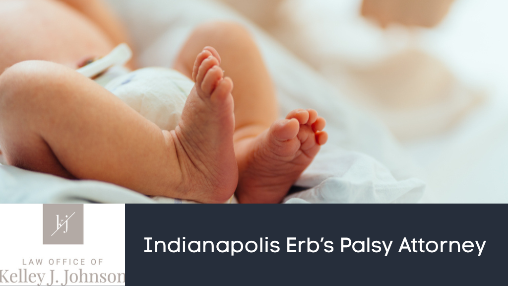 Indianapolis Erb's Palsy Lawyer