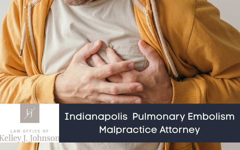 Pulmonary Embolism Malpractice