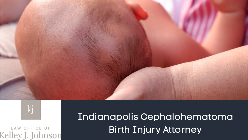 Cephalohematoma Birth Injury