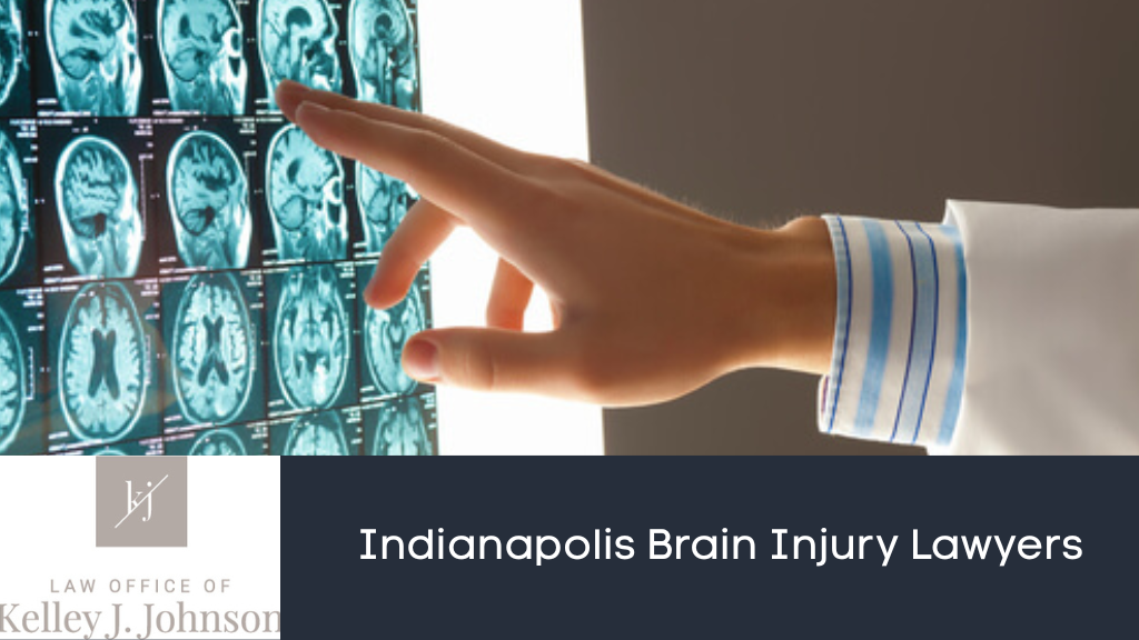 Indianapolis Brain Injury Lawyers
