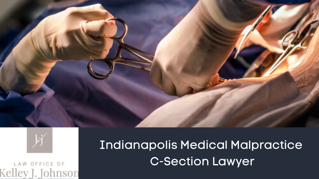 Indianapolis Medical Malpractice C-Section Lawyer 