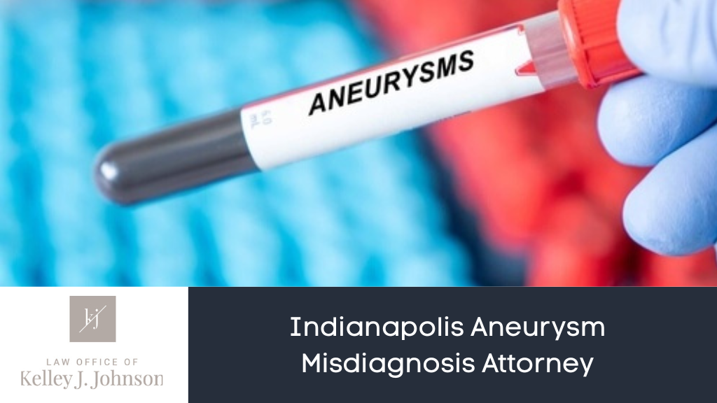 Aneurysm Misdiagnosis Attorney
