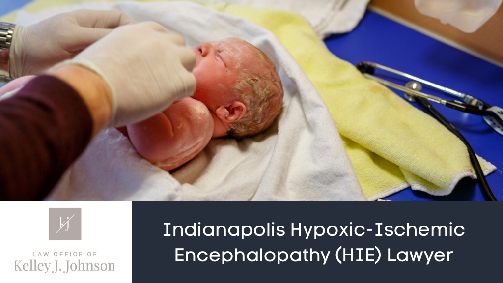 Hypoxic Ischemic Encephalopathy Lawyer