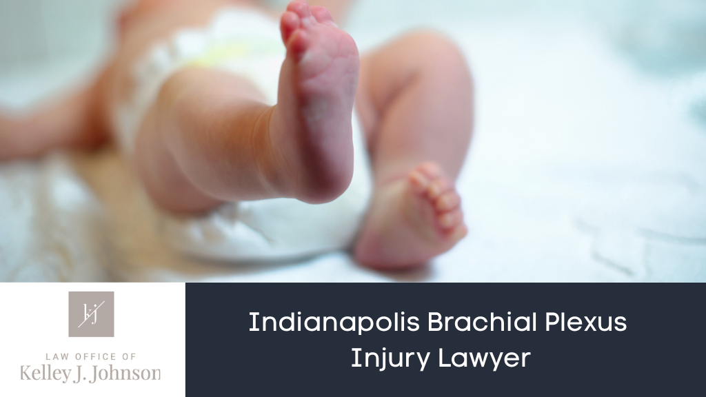Indianapolis Brachial Plexus Injury Lawyer