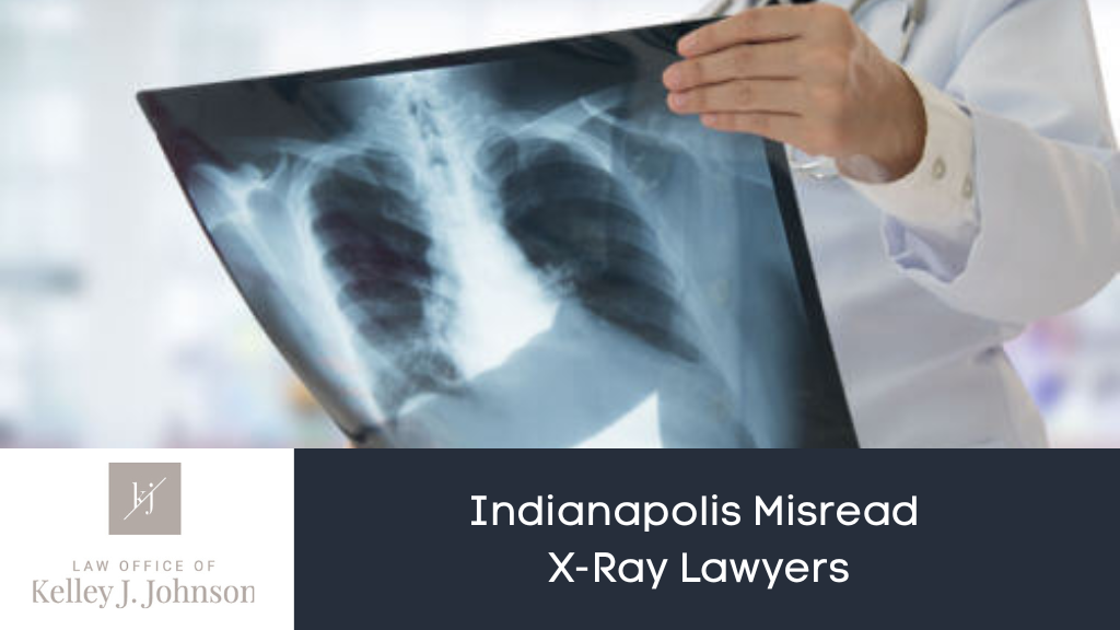 Misread X-Ray Lawyers