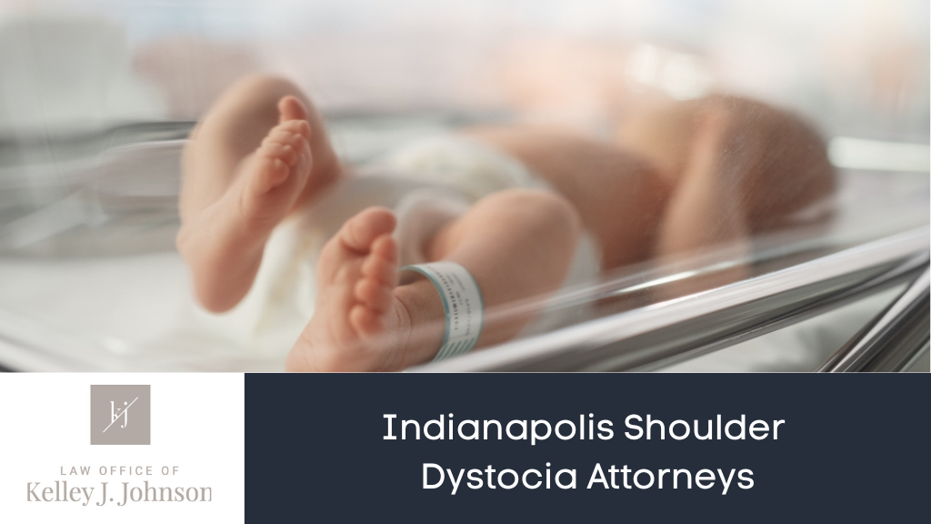 Indianapolis Shoulder Dystocia Attorneys