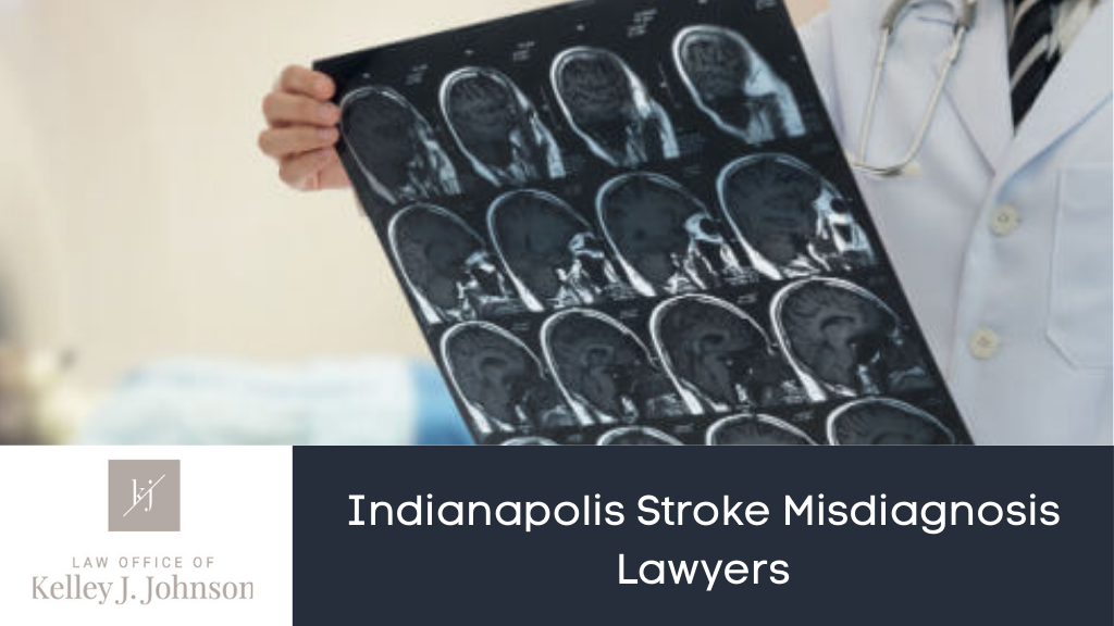 Indianapolis Stroke Misdiagnosis Lawyers