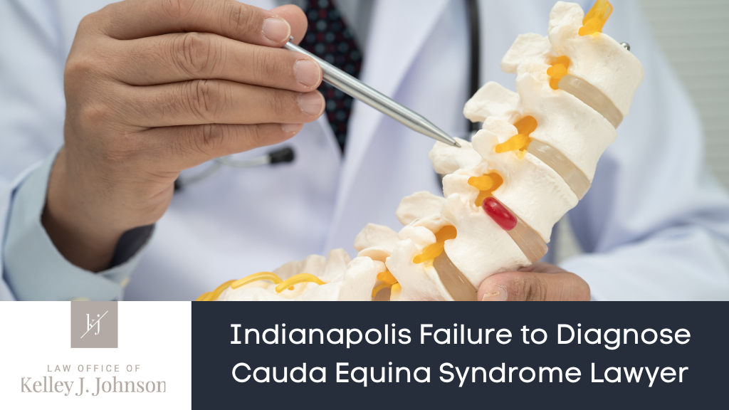 Cauda Equina Syndrome Lawyer