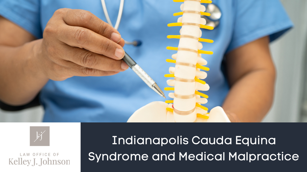 Cauda Equina Syndrome and Medical Malpractice