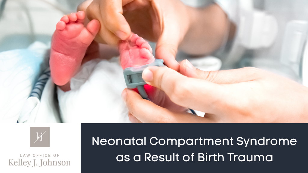 Neonatal Compartment Syndrome as a Result of Birth Trauma